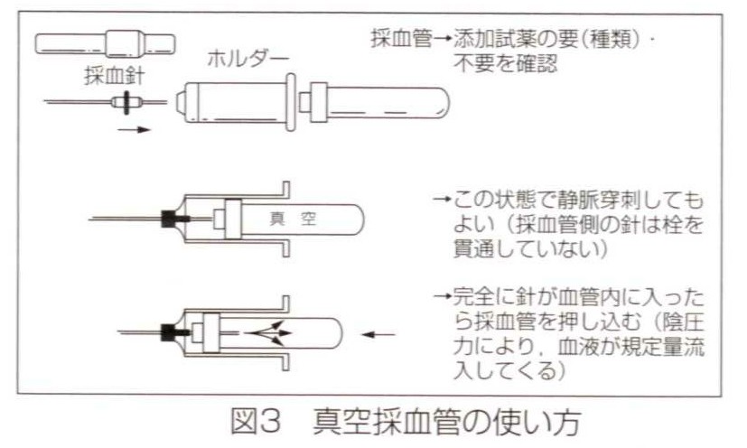 採血 スピッツ